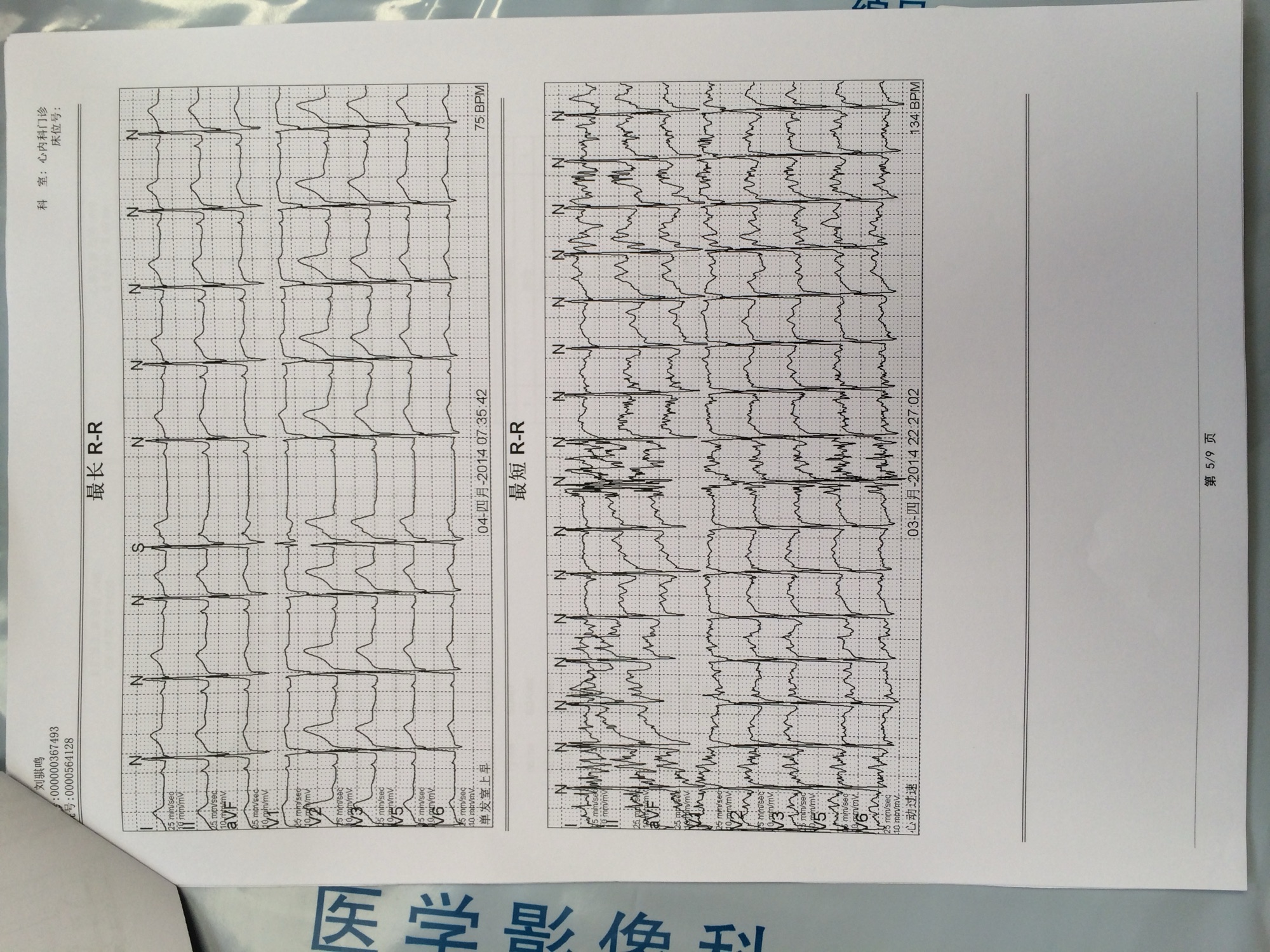 24 Hours in Beijing for a Heart 15,458 Days Old: document 08