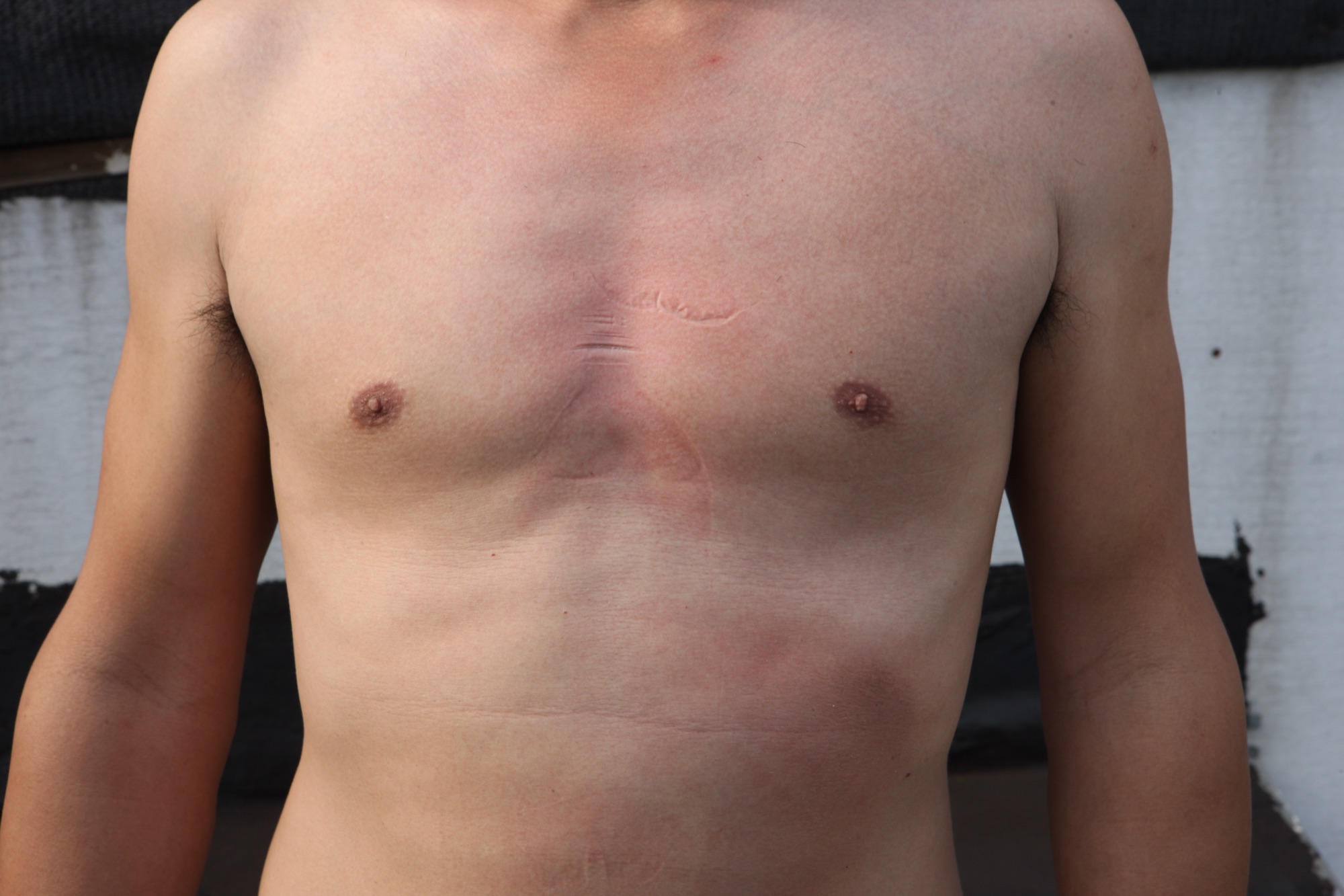 Qiming Liu (39.998595, 116.507515): Sunbathing · Anthropometry: document 14